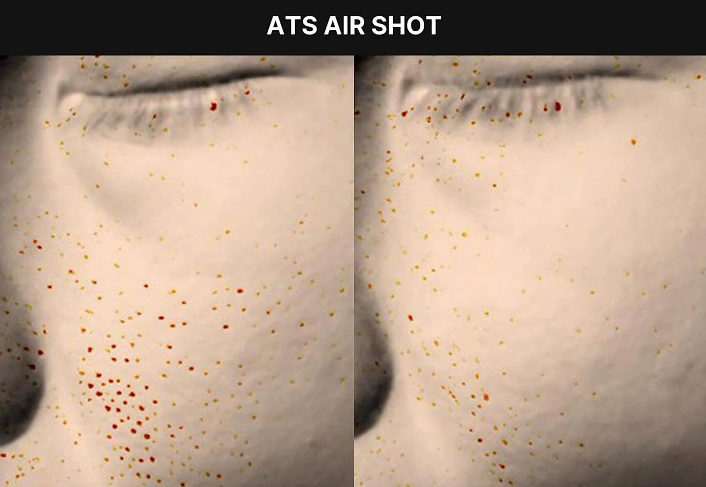 LumiSkin High-Frequency Facial Wand