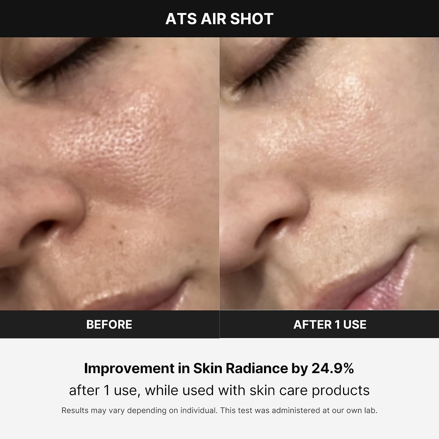 Age-R Air Shot – Korean Pore Refining Device