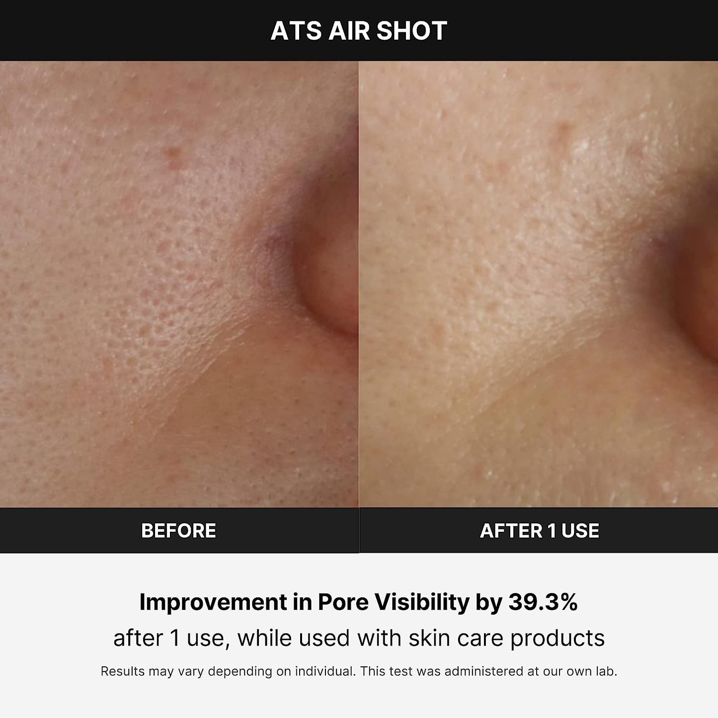 Age-R Air Shot – Korean Pore Refining Device