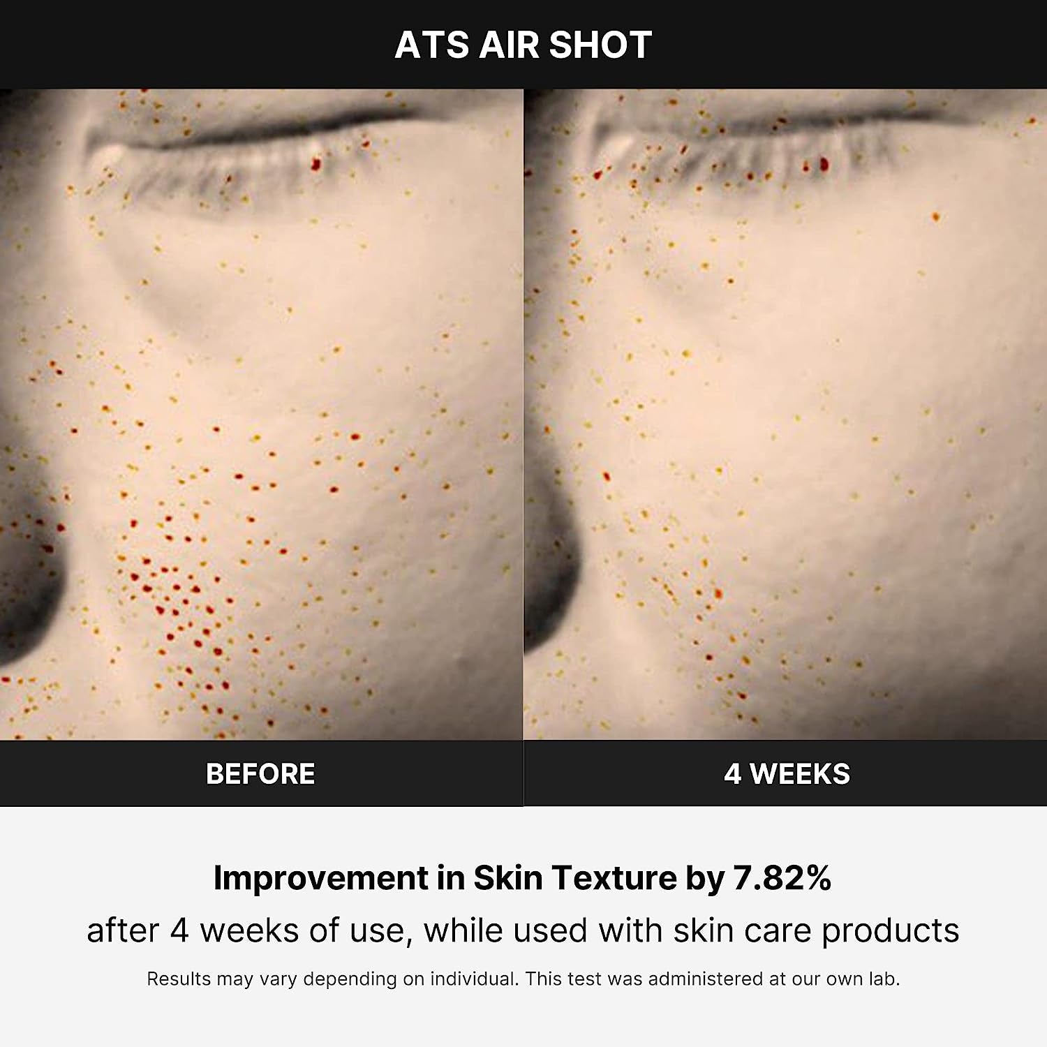Age-R Air Shot – Korean Pore Refining Device